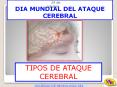 DIA MUNDIAL DEL ATAQUE CEREBRAL