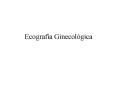 Ecografa Ginecolgica