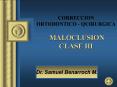 CORRECCION ORTODONTICO QUIRURGICA MALOCLUSION CLASE III