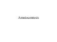 Amniocentesis