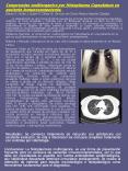 Compromiso multiorganico por Histoplasma Capsulatum en paciente inmunocompetente' Blanco F, Nuez J,