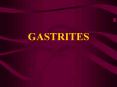 GASTRITES