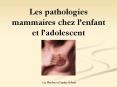 Les pathologies mammaires chez lenfant et ladolescent