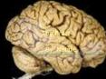 The Brain