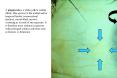 Diseases of the Eye