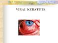 VIRAL KERATITIS
