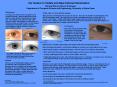 Iris Texture In Visible and NearInfrared Illumination