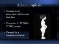 Achondroplasia