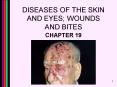 DISEASES OF THE SKIN AND EYES WOUNDS AND BITES