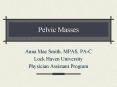 Pelvic Masses