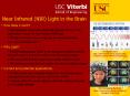 Near Infrared NIR Light in the Brain