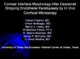 Corneal Interface Morphology After Descemet Stripping Endothelial Keratoplasty by In Vivo Confocal M