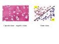 Capsule stain 