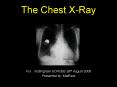 The Chest XRay