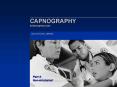 Part 3: Capnography in the Nonintubated Patient