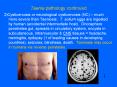 Taenia pathology continued