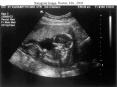 Sonogram Image, Boston, MA', 2003