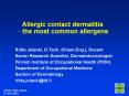 Allergic contact dermatitis the most common allergens