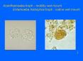 Acanthamoeba troph motility wet mount Entamoeba histolytica troph iodine wet mount