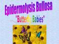 Epidermolysis Bullosa
