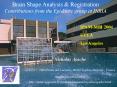 Brain Shape Analysis