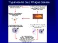 Trypanosoma cruzi:Chagas disease