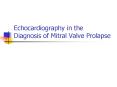 Echocardiography in the Diagnosis of Mitral Valve Prolapse