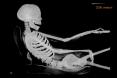 Radiation Kilo Curie