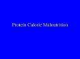 Protein Calorie Malnutrition