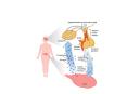 Acromegaly is a rare disorder in which the anterior pituitary produces too