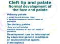Cleft lip and palate Normal development of the face and palate