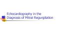 Echocardiography in the Diagnosis of Mitral Regurgitation