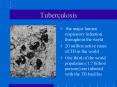 Tuberculosis