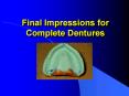 Final Impressions for Complete Dentures