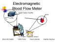 Electromagnetic