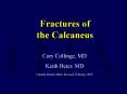 Fractures of the Calcaneus
