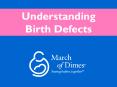 Understanding Birth Defects