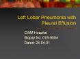Left Lobar Pneumonia with Pleural Effusion