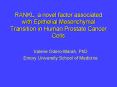 RANKL, a novel factor associated with Epithelial Mesenchymal Transition in Human Prostate Cancer Cel