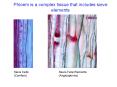 Phloem is a complex tissue that includes sieve elements