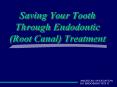 Saving Your Tooth Through Endodontic Root Canal Treatment