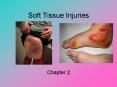 Soft Tissue Injuries