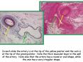 In each slide the artery is at the tip of the yellow pointer and the vein is at the tip of the green