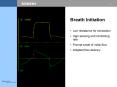 Comparison of four ventilators' Chart kindly provided by M'Heulett' Mechanical Ventilation in Anesth
