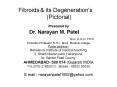 Fibroids